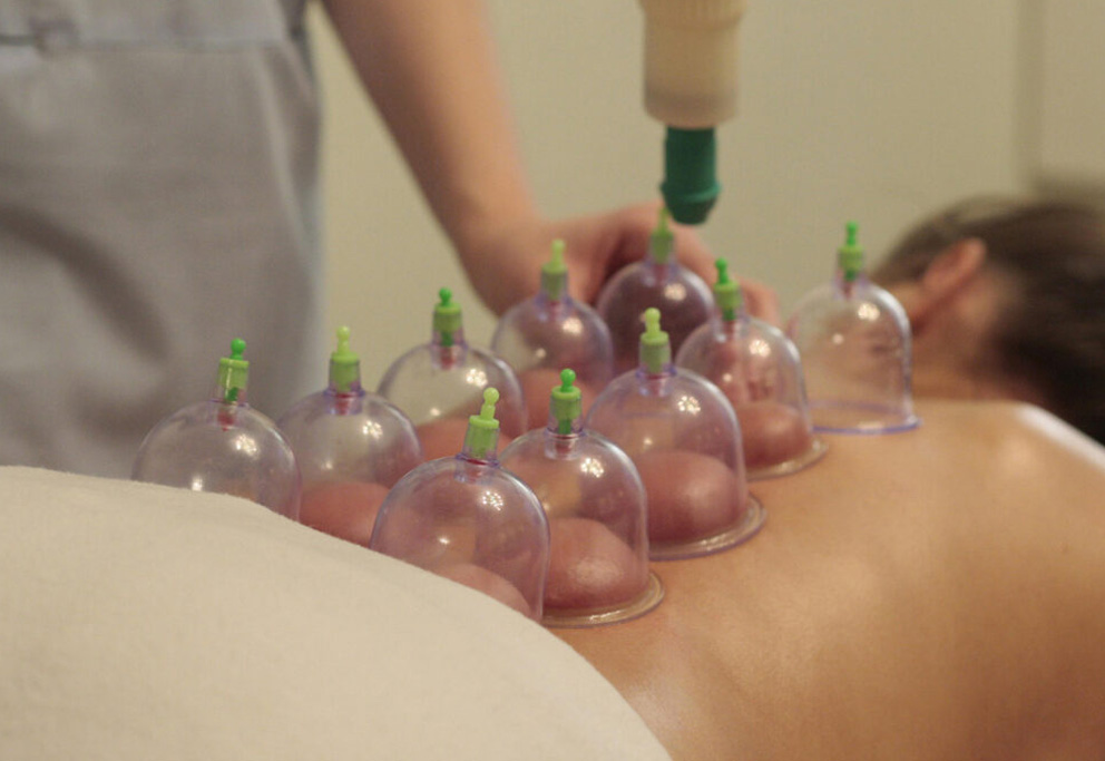 Cupping courses are available at Touch Tuina