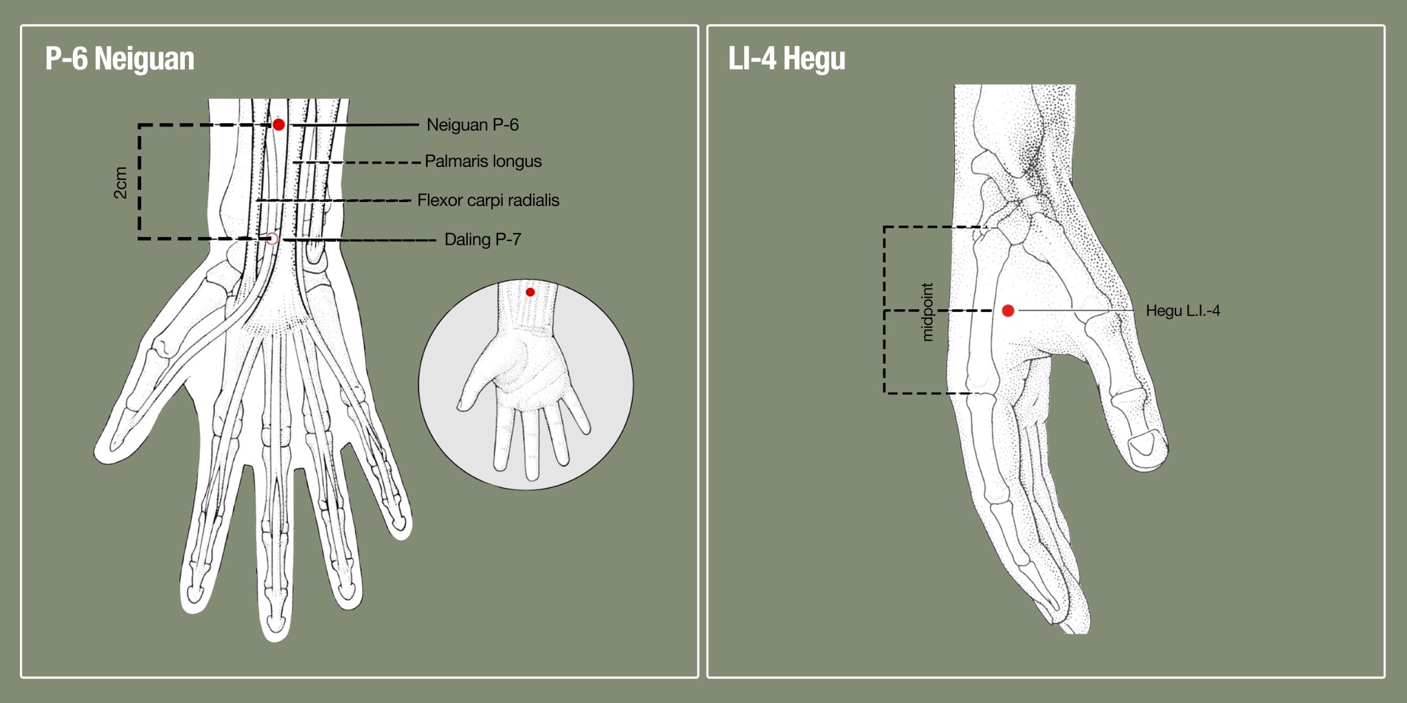 Acupuncture points for self-healing