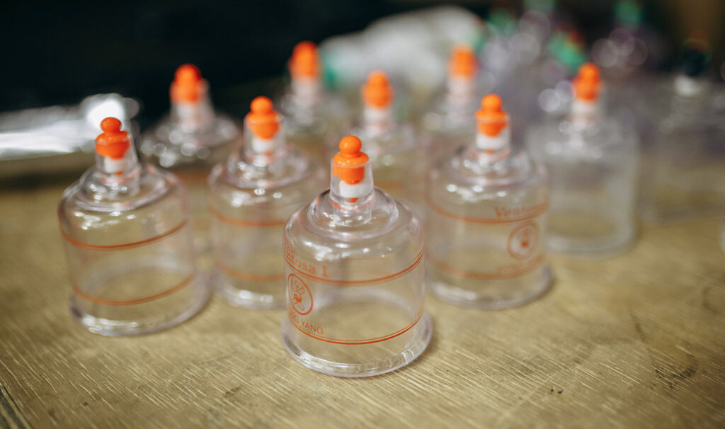 Cupping Therapy is available at Touch Tuina clinics