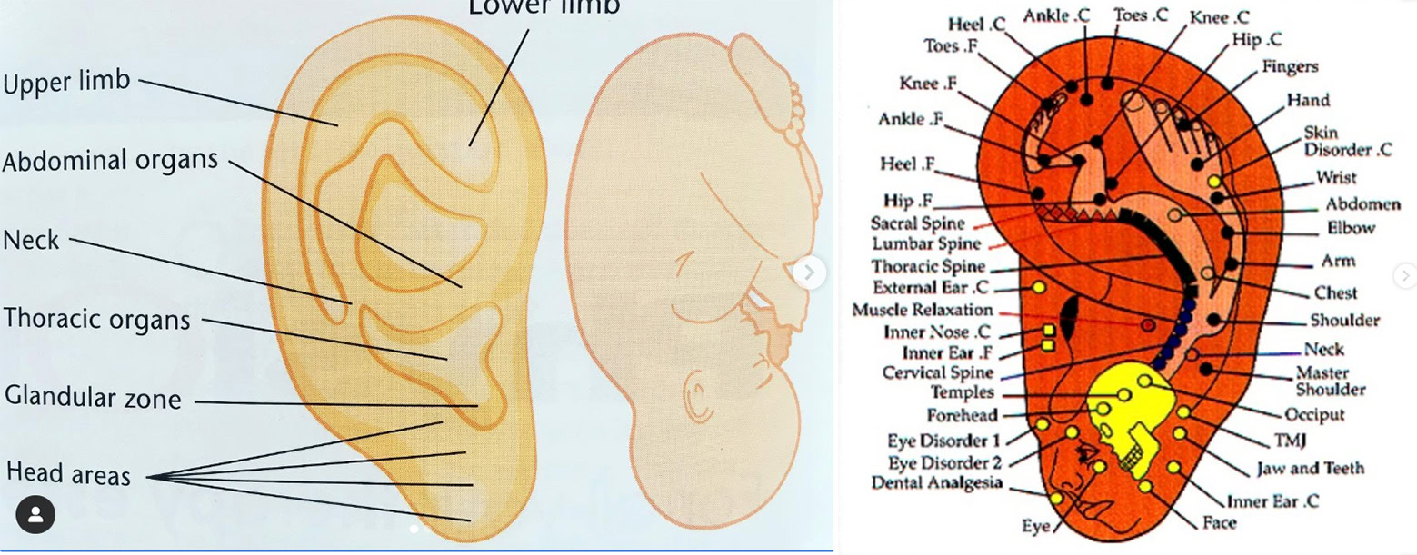 What is Auriculotherapy?